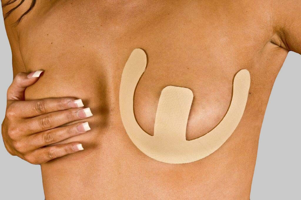 What are the options for breast reduction incision?