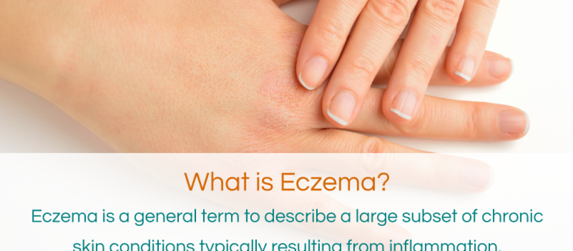 Copy of _What-is-Eczema-